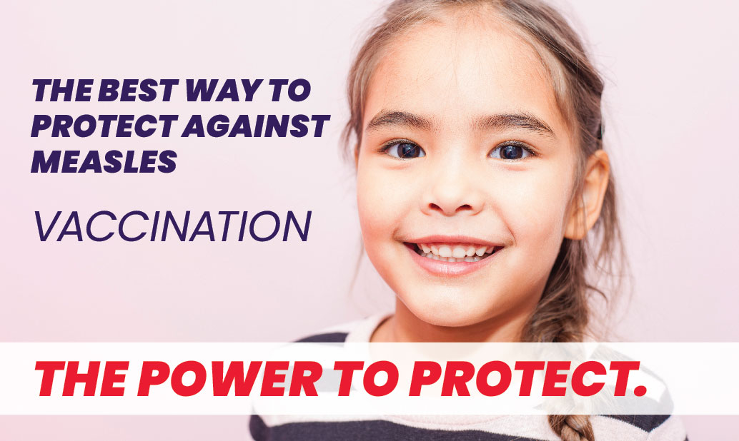 Canada Faces Measles Outbreak: Elimination Status In Jeopardy Canada Faces Measles Outbreak: Elimination Status In Jeopardy