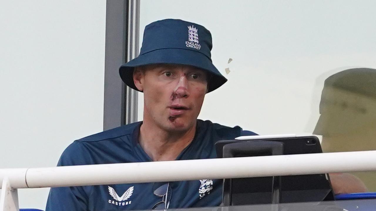 Flintoff's Honest Reflection: A Car Crash And A Battle For Survival Flintoff's Honest Reflection: A Car Crash And A Battle For Survival