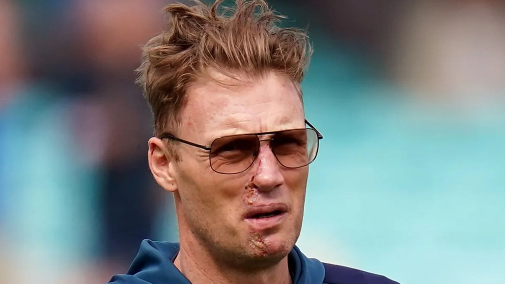 Freddie Flintoff's Car Crash: The Upcoming Disney+ Documentary Freddie Flintoff's Car Crash: The Upcoming Disney+ Documentary