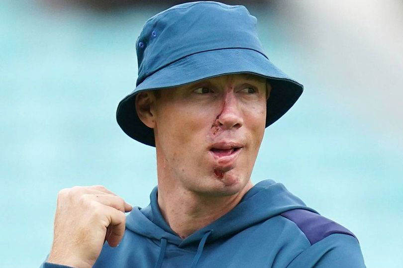 Freddie Flintoff's Crash: A Disney+ Documentary Unveiled Freddie Flintoff's Crash: A Disney+ Documentary Unveiled