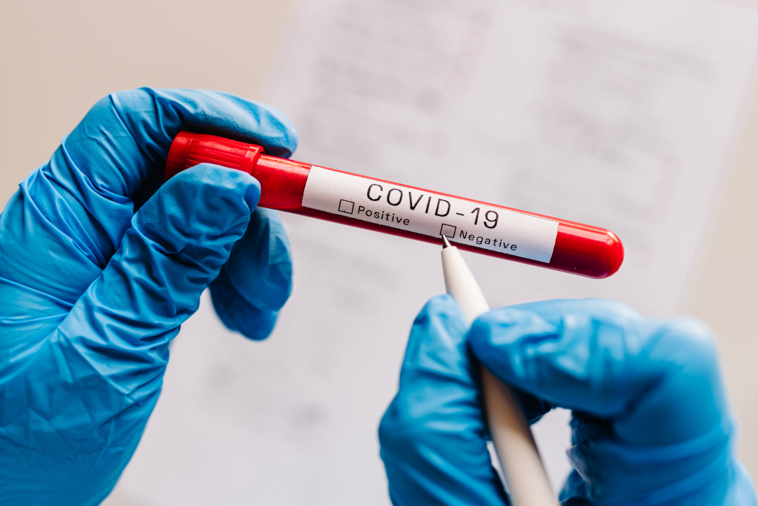 Lab Owner Pleads Guilty To COVID Test Result Fraud Lab Owner Pleads Guilty To COVID Test Result Fraud