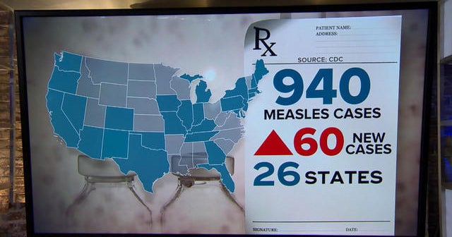 Measles Cases In US Increase To 1,046; Indiana Outbreak Ends