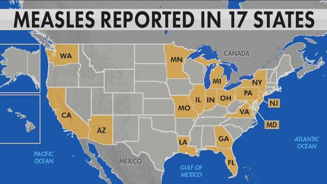 Measles Outbreak In Kansas: A Growing Concern Measles Outbreak In Kansas: A Growing Concern