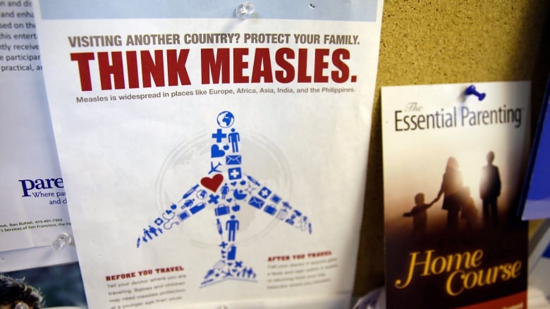 Measles Resurgence Threatens Canada's Elimination Status This Fall Measles Resurgence Threatens Canada's Elimination Status This Fall