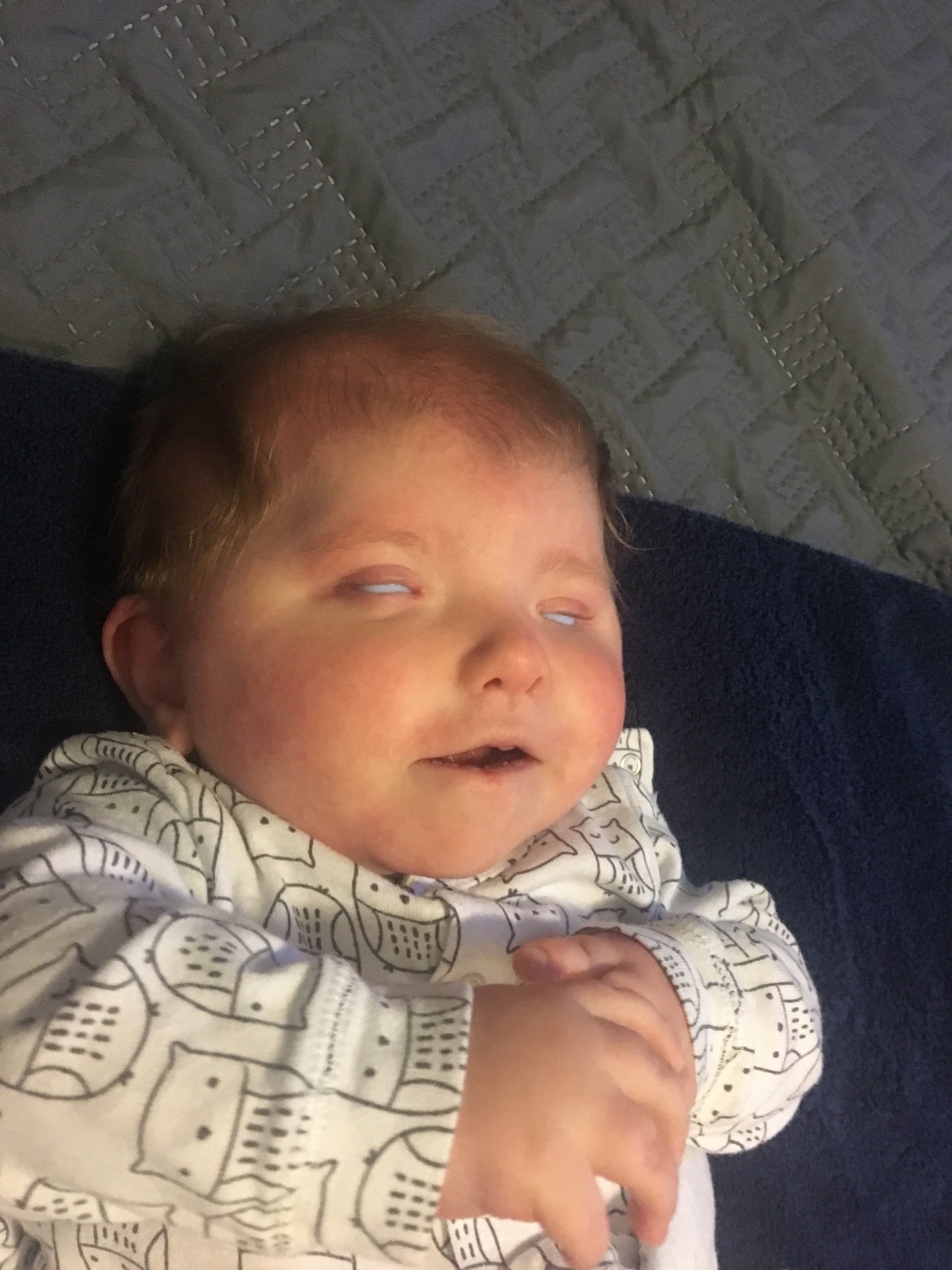Rare Condition: Bilateral Anophthalmia – Information And Resources For Parents Of Affected Infants Rare Condition: Bilateral Anophthalmia – Information And Resources For Parents Of Affected Infants