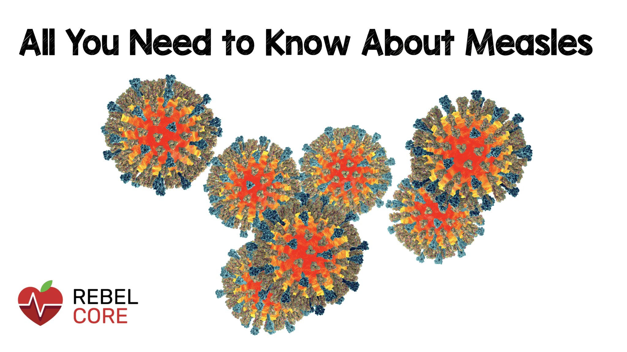 Sacramento County Wastewater Tests Positive For Measles: What You Need To Know Sacramento County Wastewater Tests Positive For Measles: What You Need To Know