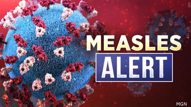 Virginia's Second Measles Case Of 2025: Details And Public Health Response Virginia's Second Measles Case Of 2025: Details And Public Health Response